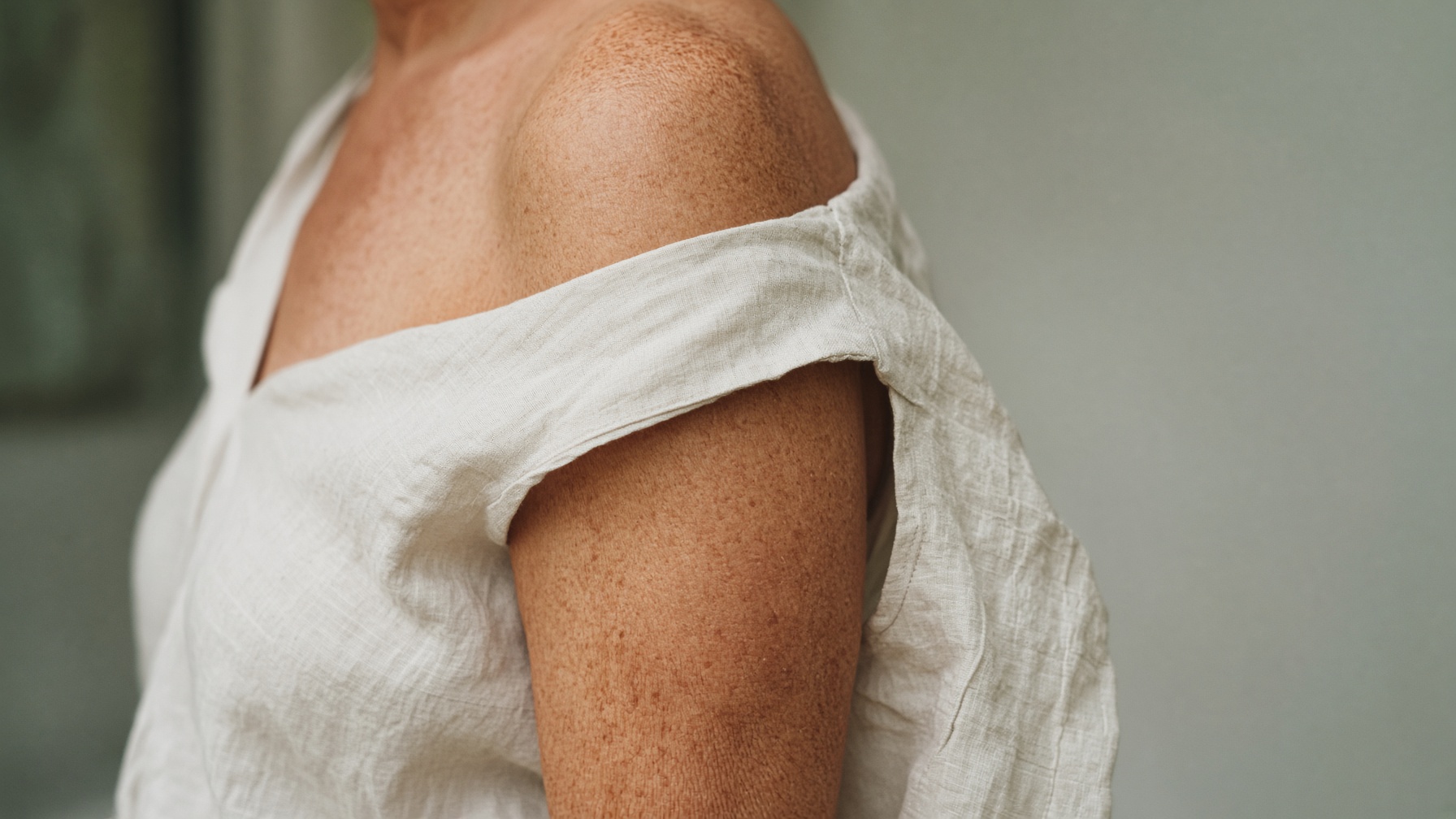 Sun-freckled shoulder and upper arm, Australian light