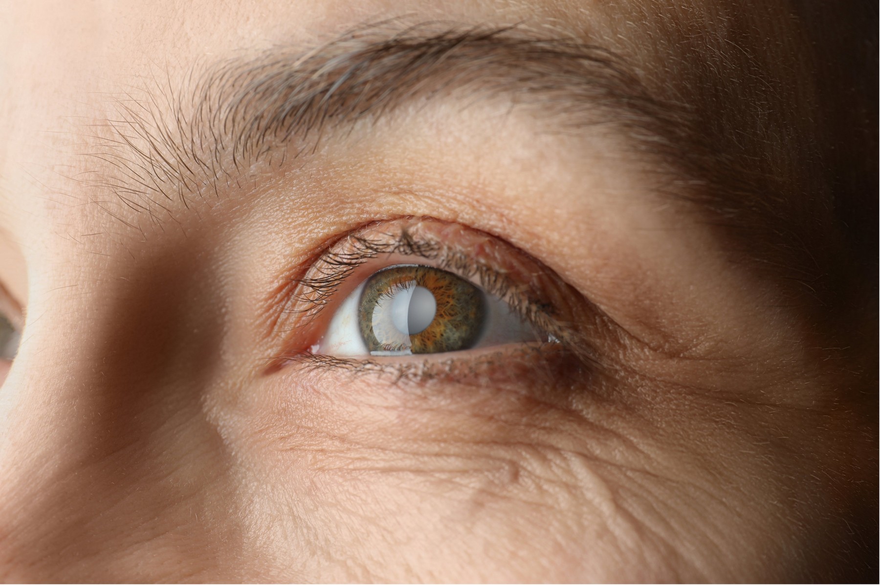 Close-up of an adult eye, brow and surrounding skin